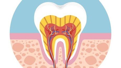 치아 신경치료, 뜻밖의 부수 효과 “당뇨·심장병 위험 감소”