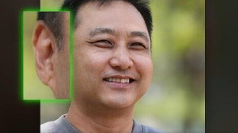 “김수용 귓불 주름, 심근경색 전조? 노화현상”…전문의 진단