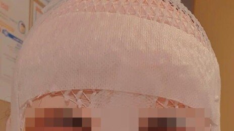 “한국인 남편이 얼굴에 뜨거운 물 부었다”…태국 여성 호소