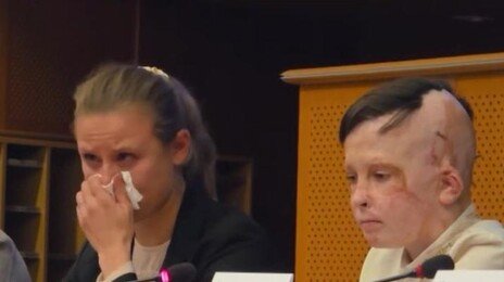 러 공습에 36회 수술 우크라 소년 “절대 포기 안돼”