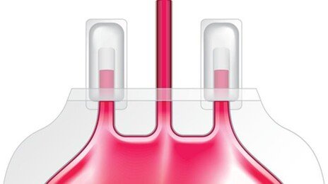 ‘늙은 피’ 수혈 → 치매 가속화 …‘젊은 피’는 뇌 보호 효과