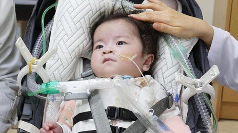 심장이 몸밖에 나온 아기… 서린이의 기적