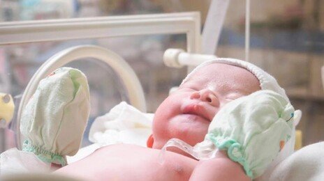 “생존율 1%의 기적”…328g 극초미숙아 191일 만에 집으로