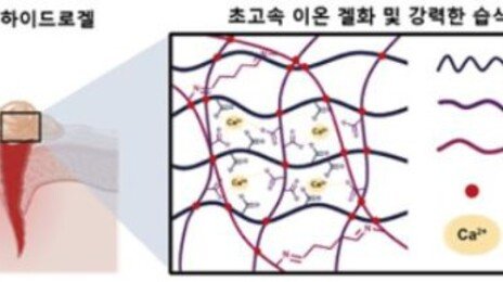 뿌리면 1초만에 지혈…카이스트 현역 소령이 개발 참여했다