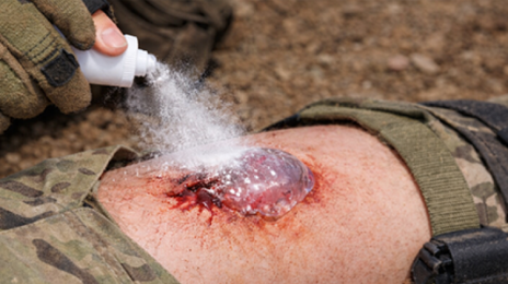 뿌리면 1초만에 지혈…카이스트 현역 소령이 개발 참여했다