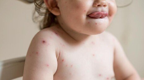 파스 붙여도 찢어질 듯 아파…모르고 지나치기 쉬운 이 병