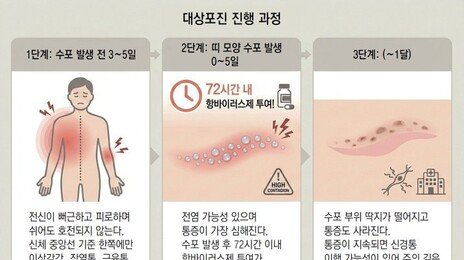 “대상포진 나은 줄 알았는데…” 치료 늦으면 신경통 ‘지옥’