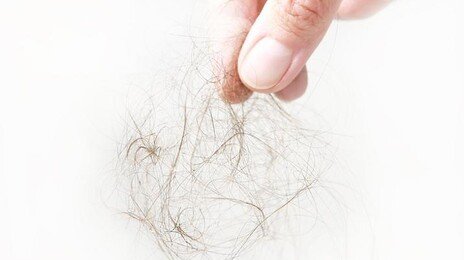 “대머리였어?” 결혼 1년만에 가발 착용 남편 고소