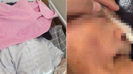 “노모 숨 못 쉬게 수건 덮어놨다”…요양병원 보호자 분노