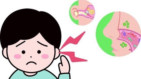 초등생 중이염 오래가면, 코 뒤쪽 ‘아데노이드 서식 세균’ 의심