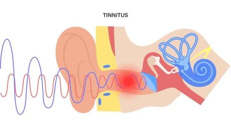 “노벨상 감인데 왜 유튜브에?”…이명 광고 일침 날린 전문의 [건강팩트체크]