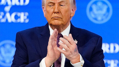 “테이블에 부딪혀”…트럼프 대통령 손에 멍자국 생기자 해명