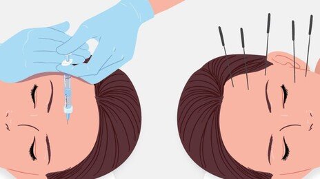 주사값 3분의 1로 피부재생 약침 시술… 한의원 미용진료 논란