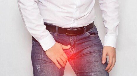 남성 불임 환자 절반에서 ‘정계정맥류’ 질환… 확장된 정맥 선택적 차단, 혈류 역류 막아야