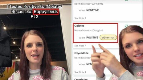 토스트에 뿌린 이것 때문에?…美 임산부 ‘마약 양성’ 황당 사건