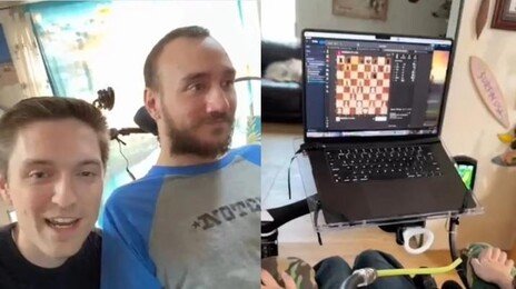 “시각장애인도 앞 볼수있는 증강기술 개발”