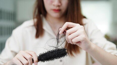 “탈모는 ‘미니 장기’ 모낭 손상 결과”… 학계에선 ‘질병’ 인정