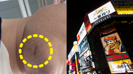 “앞니 3개 부러지고 피범벅” 韓관광객 日서 집단폭행 당해