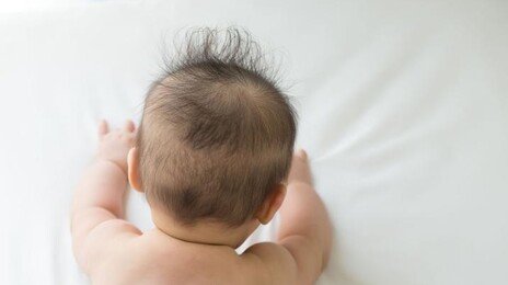 ‘예쁜 두상’ 교정헬멧 쓰는 아이들…“생활 습관 더 중요”