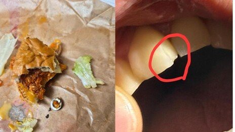 “햄버거 먹다가 이빨 깨졌다”…본사가 내놓은 보상비용은?