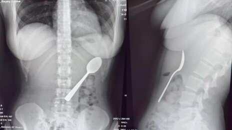 입에 숟가락 물고 문자 하다…강아지 뛰어들어 ‘꿀꺽’