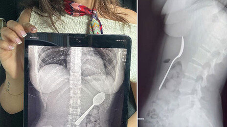 입에 숟가락 물고 문자 하다…강아지 뛰어들어 ‘꿀꺽’