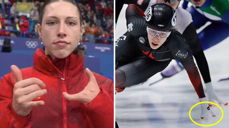 “자랑스럽다”… 두 손가락으로 일군 ‘불굴의 銀’