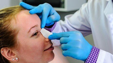 “수술 절반이 재수술”…美 성형외과 의사, 코 성형·필러 수정 최다