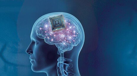 ‘뇌에 칩이식’ 성공한 中… 머스크 ‘뉴럴링크’ 맹추격