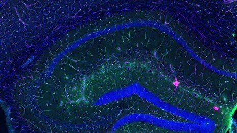 운동이 뇌를 보호하는  ‘생물학적 기전’ 발견