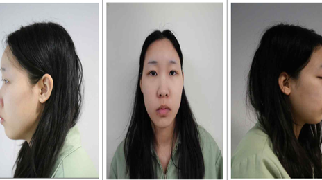 “모텔 연쇄살인 피의자는 20세 김소영” 신상공개
