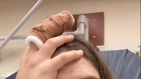 손톱 거스러미 물어뜯다가 “손가락 절단할 뻔”…조직 괴사
