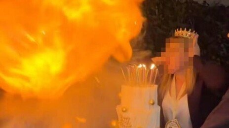 “생일날 얼굴이 화염에”…‘불 뿜기’ 챌린지 하다가 중화상