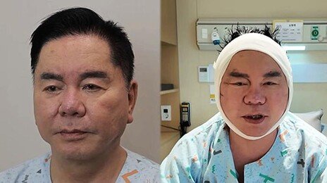 64세 윤영미 확 바뀐 외모…“용기 내길 잘했다 생각” [노화설계]