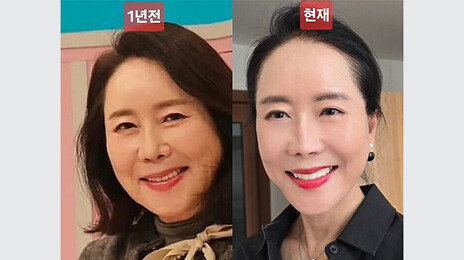 64세 윤영미 확 바뀐 외모…“용기 내길 잘했다 생각”