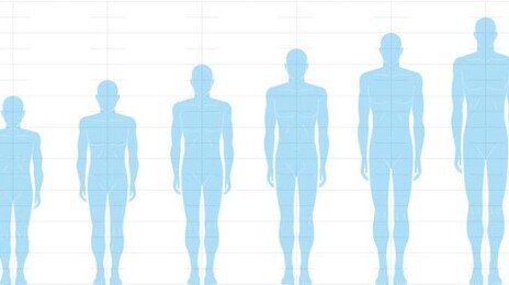 키 큰 사람 ‘이 질환’ 위험 높다…동아시아인 12만 명 유전 분석