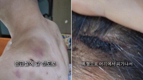 “다락방 가두고 요강 쓰라고…” 직원 감금·폭행한 중국집 사장