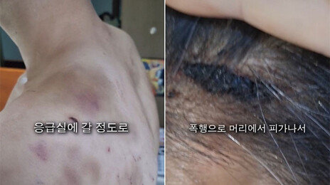 “다락방 가두고 요강 쓰라고…” 직원 감금·폭행한 중국집 사장