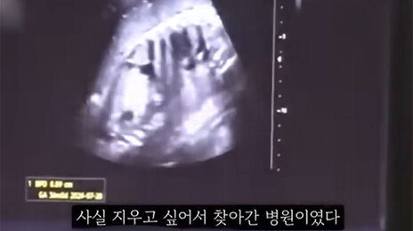 ‘36주 낙태’ 20대女, 50대 교제남이 수술비 내주고 떠났다