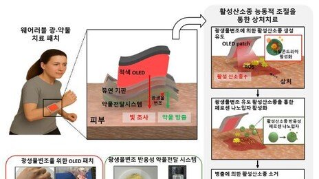 상처에 빛 쬐어 약물량 조절 ‘OLED 패치’ 개발