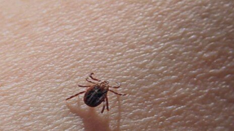 백신도 약도 없다…‘이것’에 물리면 구토-설사에 사망까지
