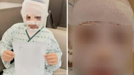 끓는 물 부은 남편 감쌌던 아내 “처벌 원해” 마음 바꿨다