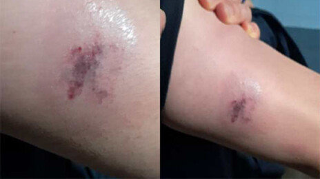 볼펜에 찍히고 급소 차이는 교도관…“예산 없다고 방호복 안줘”