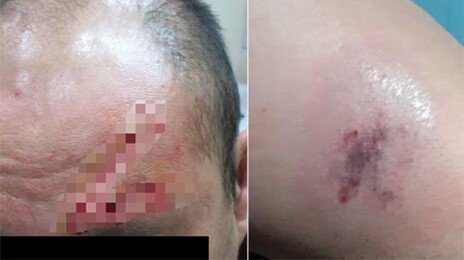 볼펜에 찍히고 급소 차이는 교도관…“분노 넘어 자괴감 든다”[더뎁스]