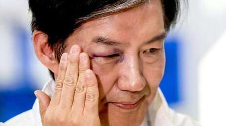 김용남, 멍든 조국에 “파란색 얼마나 부러우면 얼굴 시퍼렇게 만드나”