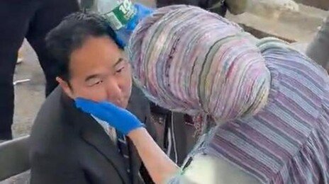 앤디 김, 反이민시위 찾았다 최루탄 맞아 부상