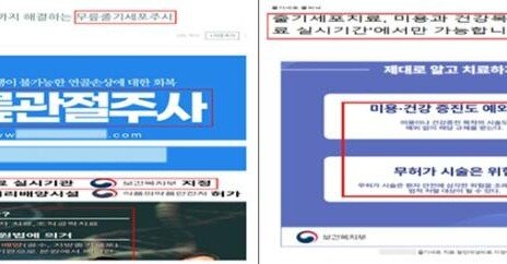 관절염 주사가 ‘줄기세포 치료’ 둔갑…의료기관 63곳 과대광고 적발