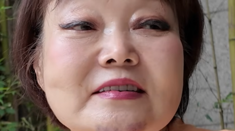 이혜정 “낙상으로 턱에 검푸른 피멍”…멍 빨리 빼는 정석은?