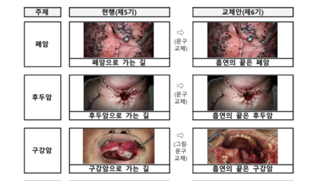 “흡연의 끝은 폐암”…담뱃갑 문구 더 강하고 직관적으로 바뀐다