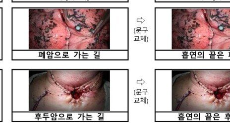 “흡연의 끝은 폐암”… 담뱃갑 경고 더 세진다